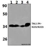 Anti-TAL1 (Acetyl-K221/K222) Antibody from Bioworld Technology (BS64094) - Antibodies.com