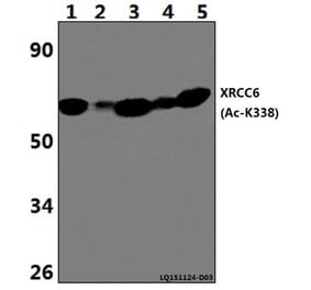 Anti-XRCC6 (Acetyl-K338) Antibody from Bioworld Technology (BS64099) - Antibodies.com