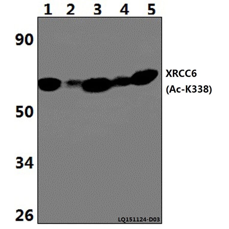 Anti-XRCC6 (Acetyl-K338) Antibody from Bioworld Technology (BS64099) - Antibodies.com