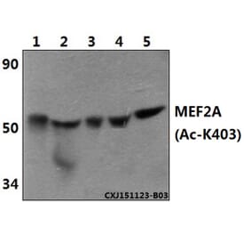 Anti-MEF2A (Acetyl-K403) Antibody from Bioworld Technology (BS64105) - Antibodies.com