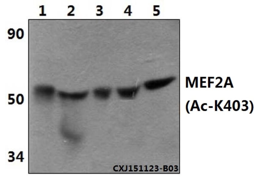 Anti-MEF2A (Acetyl-K403) Antibody from Bioworld Technology (BS64105) - Antibodies.com
