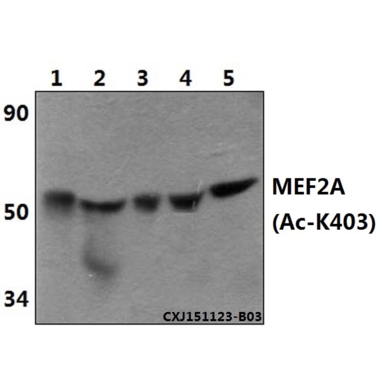 Anti-MEF2A (Acetyl-K403) Antibody from Bioworld Technology (BS64105) - Antibodies.com