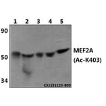 Anti-MEF2A (Acetyl-K403) Antibody from Bioworld Technology (BS64105) - Antibodies.com