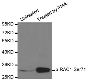 Anti-RAC1 (phospho-S71) Antibody from Bioworld Technology (BS6412) - Antibodies.com