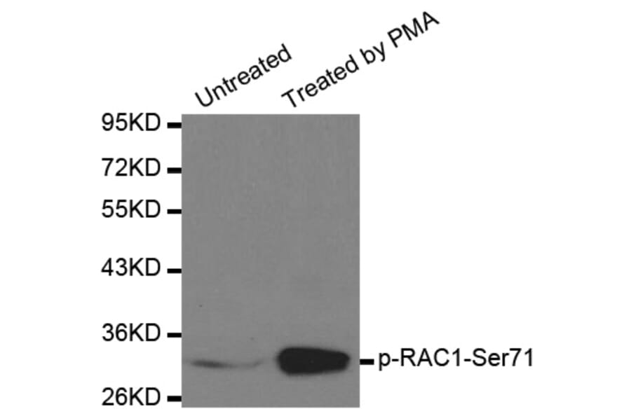 Anti-RAC1 (phospho-S71) Antibody from Bioworld Technology (BS6412) - Antibodies.com