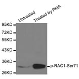 Anti-RAC1 (phospho-S71) Antibody from Bioworld Technology (BS6412) - Antibodies.com