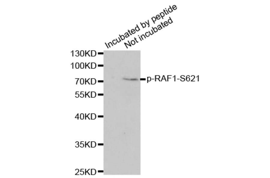 Anti-Raf-1 (phospho-S621) Antibody from Bioworld Technology (BS6413) - Antibodies.com