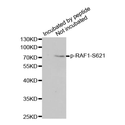 Anti-Raf-1 (phospho-S621) Antibody from Bioworld Technology (BS6413) - Antibodies.com