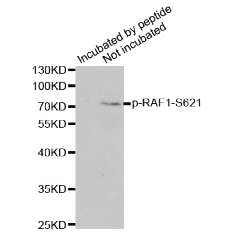 Anti-Raf-1 (phospho-S621) Antibody from Bioworld Technology (BS6413) - Antibodies.com