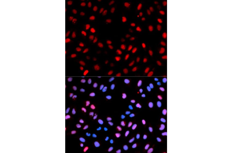 Anti-Raf-1 (phospho-S621) Antibody from Bioworld Technology (BS6413) - Antibodies.com