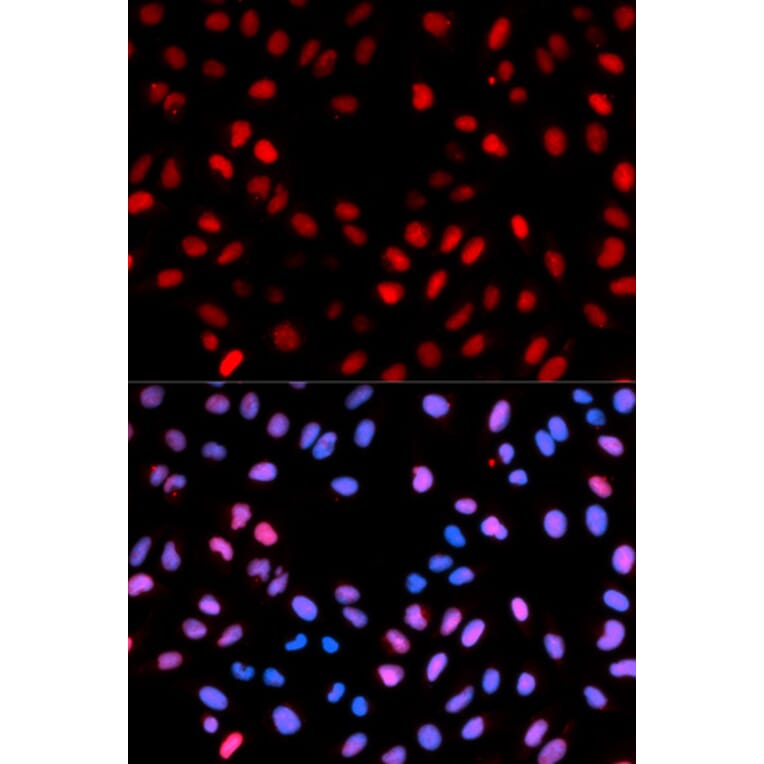 Anti-Raf-1 (phospho-S621) Antibody from Bioworld Technology (BS6413) - Antibodies.com