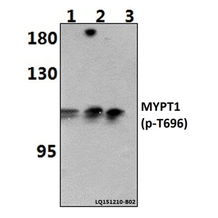 Anti-MYPT1 (phospho-T696) Antibody from Bioworld Technology (BS64148) - Antibodies.com