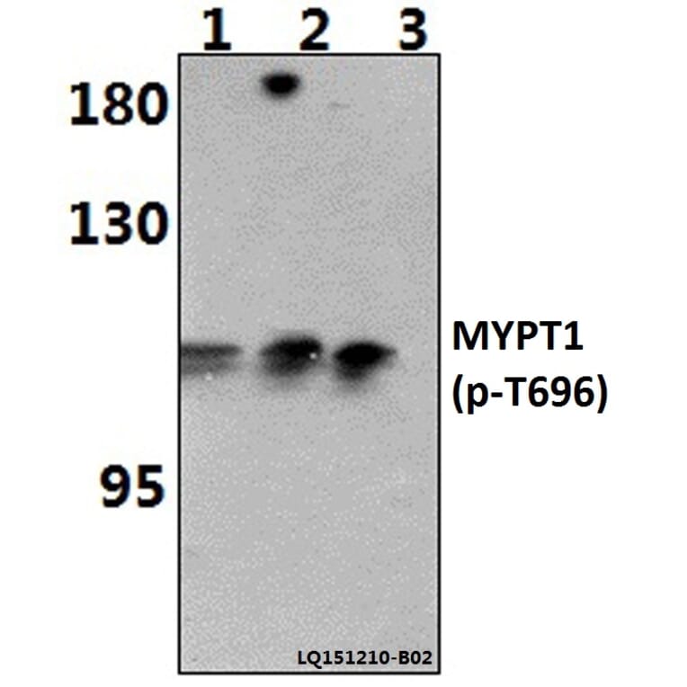 Anti-MYPT1 (phospho-T696) Antibody from Bioworld Technology (BS64148) - Antibodies.com