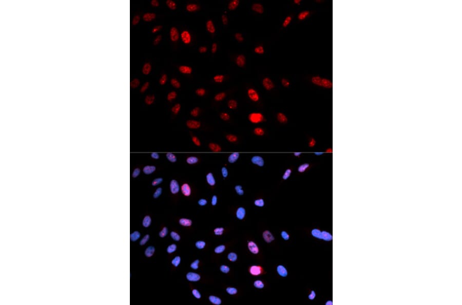 Anti-SMC 1 (phospho-S957) Antibody from Bioworld Technology (BS6416) - Antibodies.com