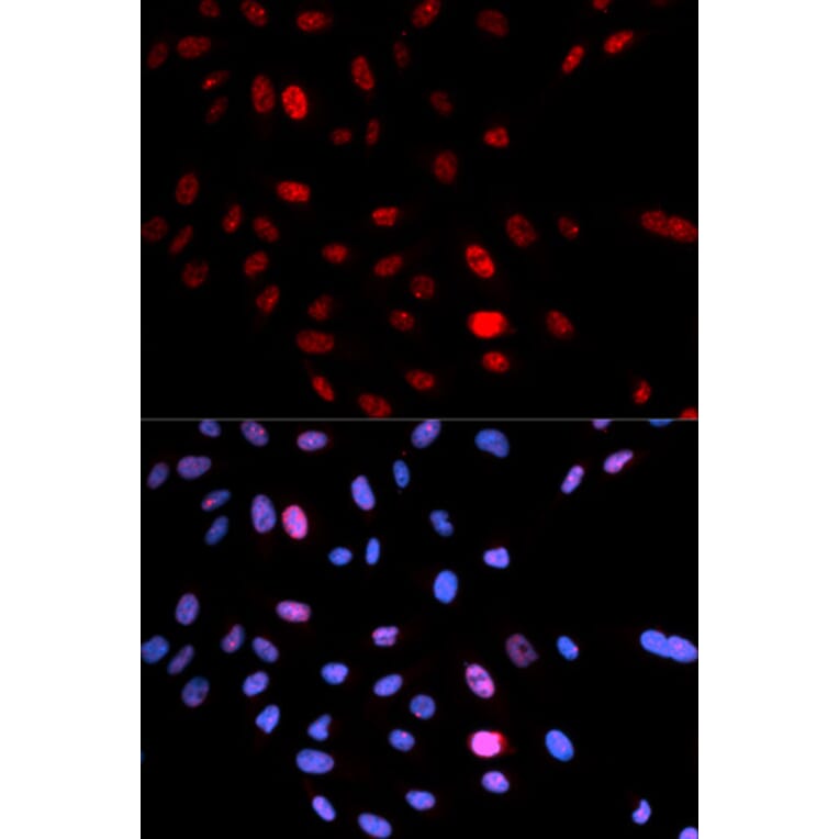 Anti-SMC 1 (phospho-S957) Antibody from Bioworld Technology (BS6416) - Antibodies.com
