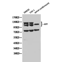 Anti-APP/β-Amyloid Antibody from Bioworld Technology (BS6418) - Antibodies.com