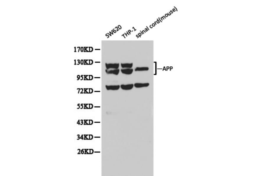 Anti-APP/β-Amyloid Antibody from Bioworld Technology (BS6418) - Antibodies.com