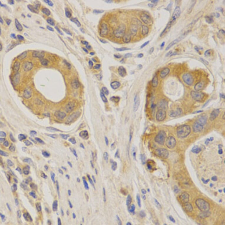 Anti-APP/β-Amyloid Antibody from Bioworld Technology (BS6418) - Antibodies.com