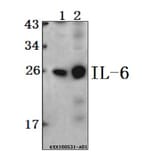 Anti-IL-6 Antibody from Bioworld Technology (BS6419) - Antibodies.com
