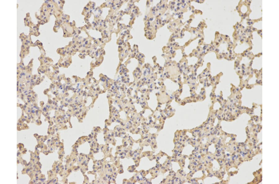 Anti-IL-6 Antibody from Bioworld Technology (BS6419) - Antibodies.com