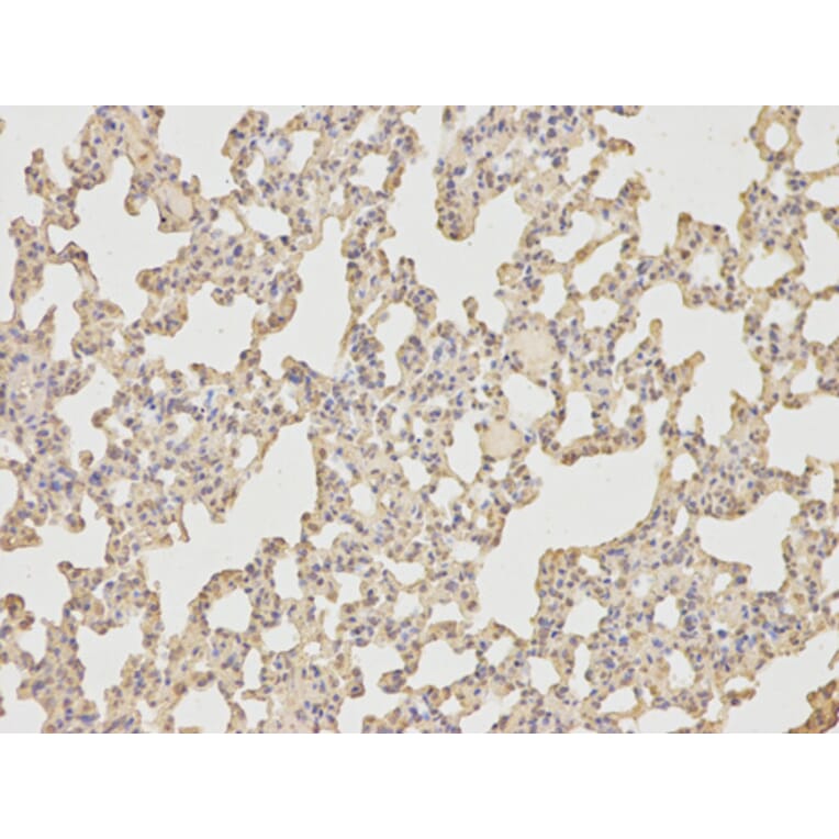 Anti-IL-6 Antibody from Bioworld Technology (BS6419) - Antibodies.com
