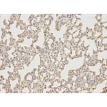 Anti-IL-6 Antibody from Bioworld Technology (BS6419) - Antibodies.com