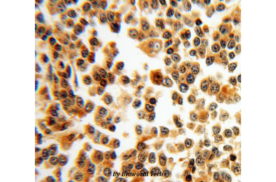 Anti-Bax Antibody from Bioworld Technology (BS6420) - Antibodies.com