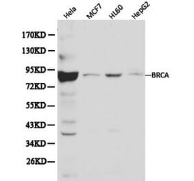 Anti-BRCA1 Antibody from Bioworld Technology (BS6423) - Antibodies.com