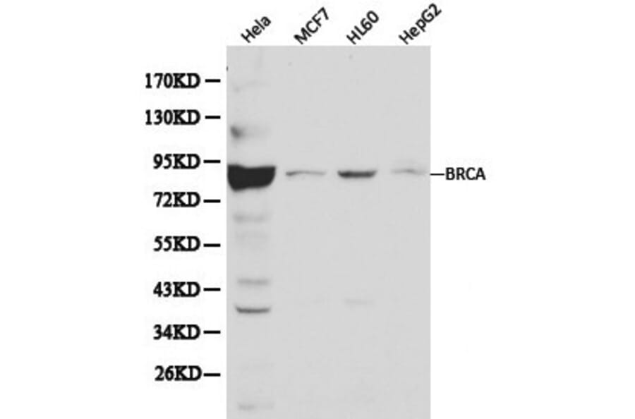 Anti-BRCA1 Antibody from Bioworld Technology (BS6423) - Antibodies.com