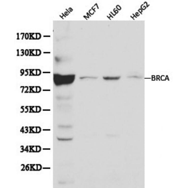 Anti-BRCA1 Antibody from Bioworld Technology (BS6423) - Antibodies.com