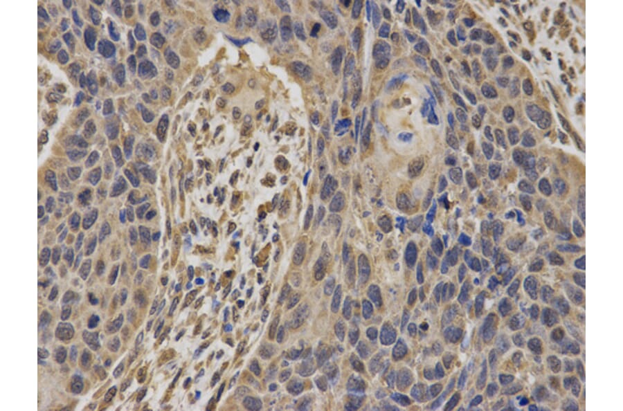 Anti-BRCA1 Antibody from Bioworld Technology (BS6423) - Antibodies.com