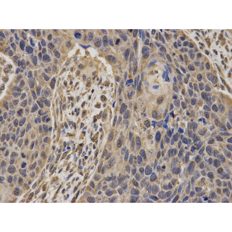 Anti-BRCA1 Antibody from Bioworld Technology (BS6423) - Antibodies.com