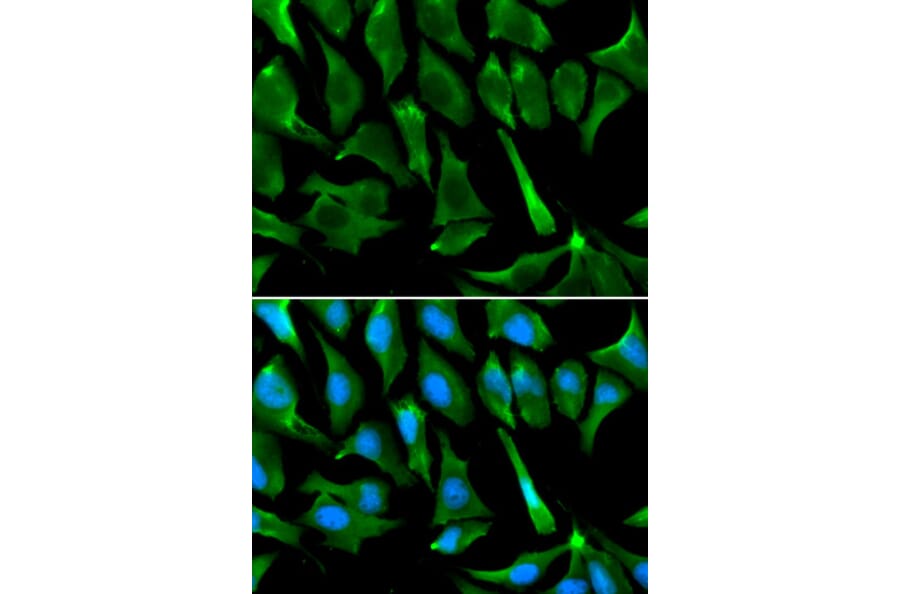 Anti-BRCA1 Antibody from Bioworld Technology (BS6423) - Antibodies.com