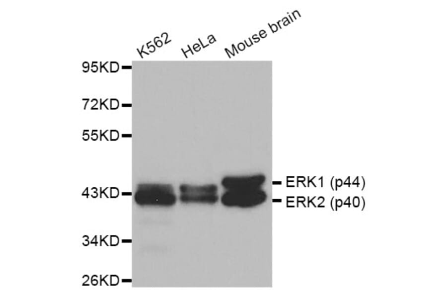 Anti-ERK1/2 Antibody from Bioworld Technology (BS6426) - Antibodies.com