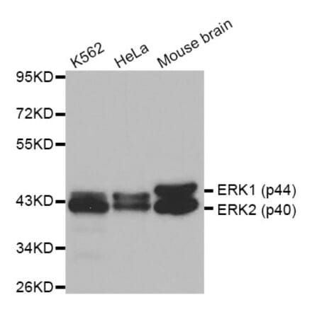 Anti-ERK1/2 Antibody from Bioworld Technology (BS6426) - Antibodies.com