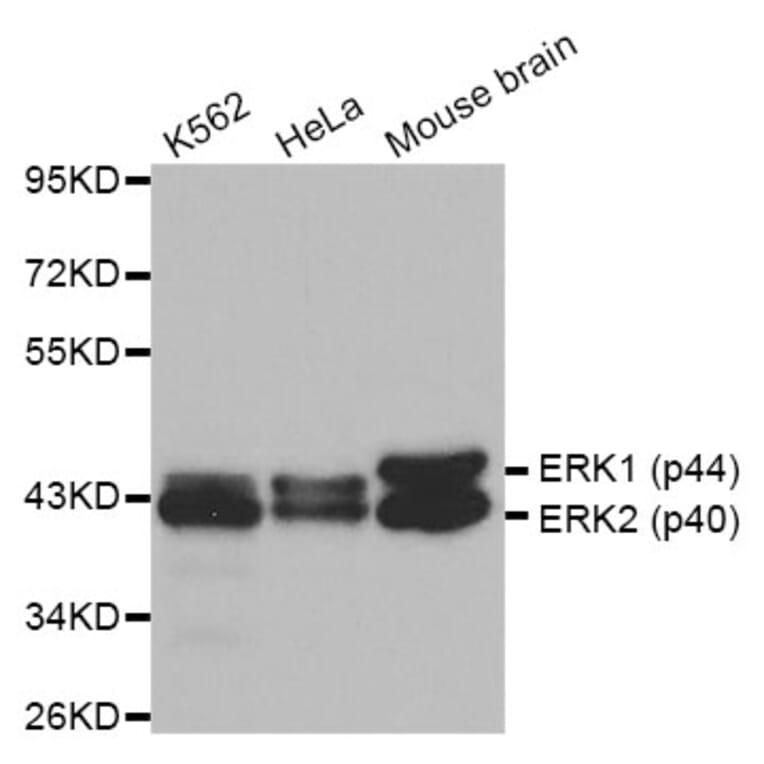 Anti-ERK1/2 Antibody from Bioworld Technology (BS6426) - Antibodies.com