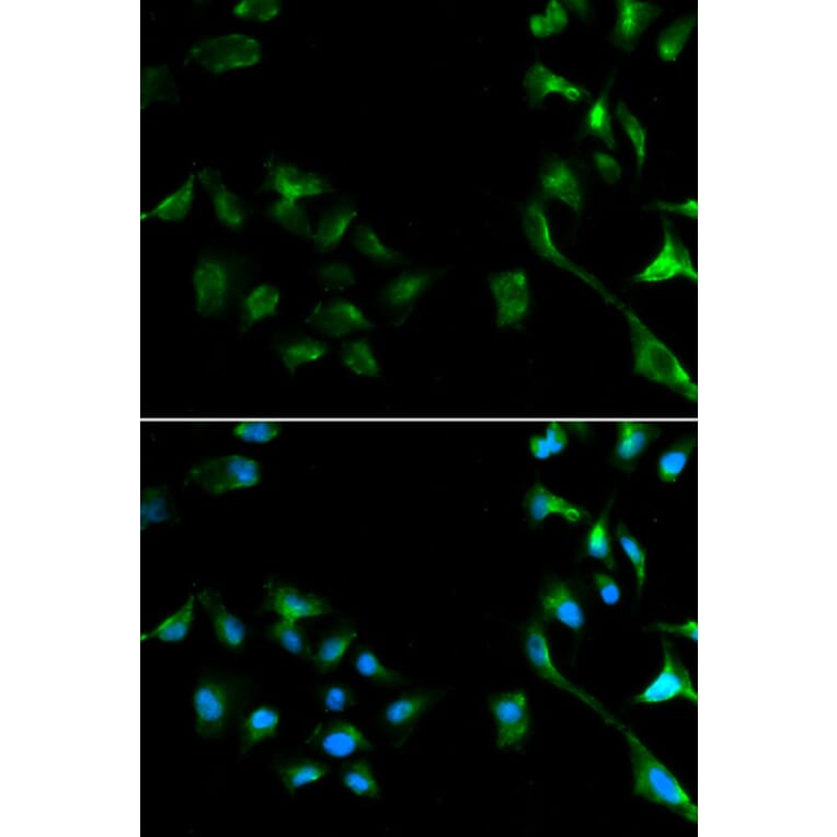 Anti-ERK1/2 Antibody from Bioworld Technology (BS6426) - Antibodies.com