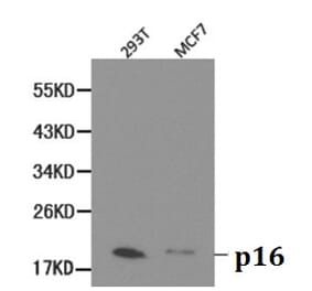 Anti-p16 INK4a Antibody from Bioworld Technology (BS6431) - Antibodies.com