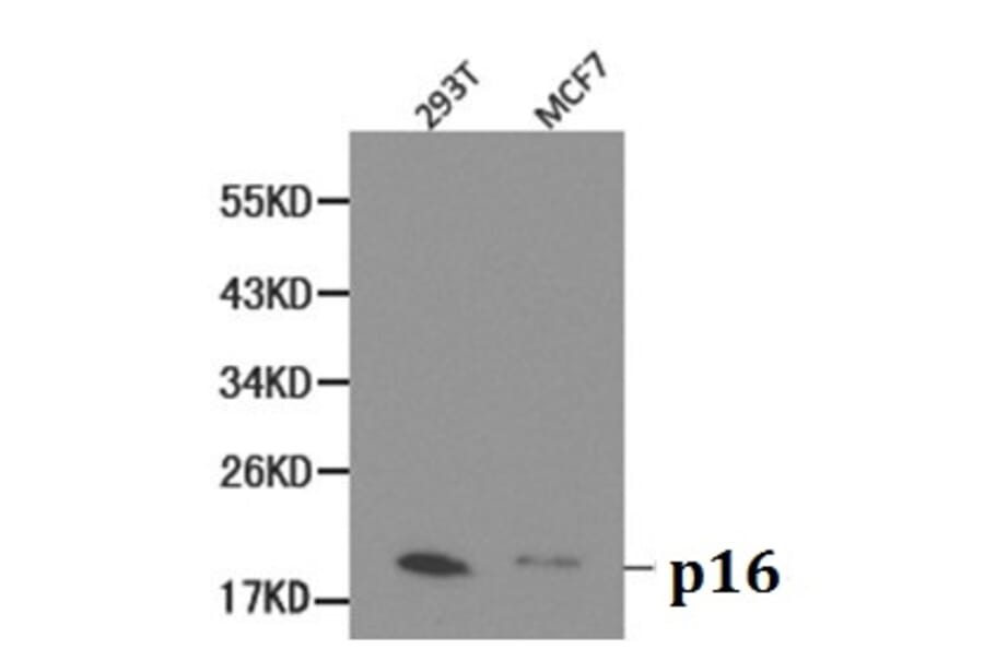 Anti-p16 INK4a Antibody from Bioworld Technology (BS6431) - Antibodies.com