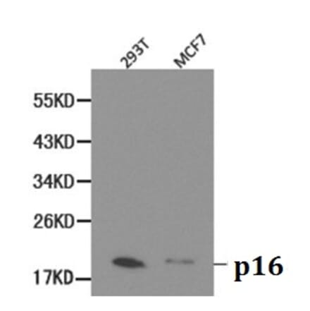 Anti-p16 INK4a Antibody from Bioworld Technology (BS6431) - Antibodies.com