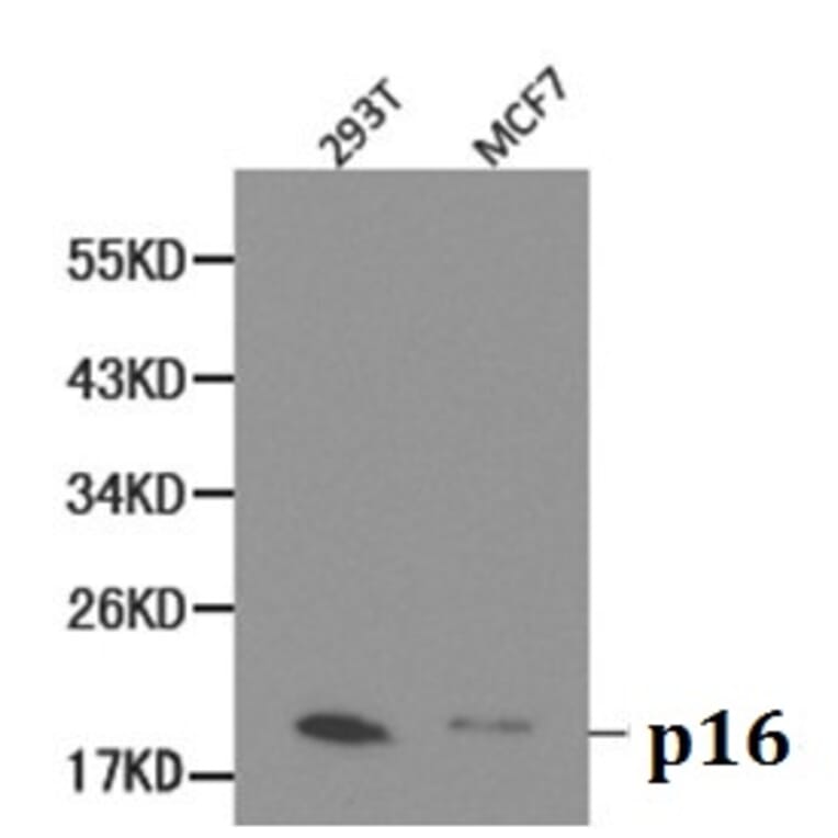 Anti-p16 INK4a Antibody from Bioworld Technology (BS6431) - Antibodies.com