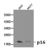 Anti-p16 INK4a Antibody from Bioworld Technology (BS6431) - Antibodies.com