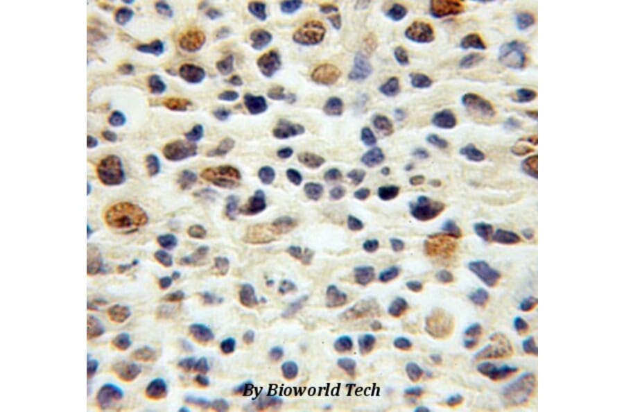 Anti-p16 INK4a Antibody from Bioworld Technology (BS6431) - Antibodies.com