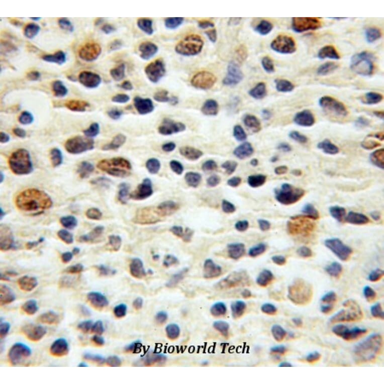 Anti-p16 INK4a Antibody from Bioworld Technology (BS6431) - Antibodies.com