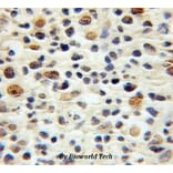 Anti-p16 INK4a Antibody from Bioworld Technology (BS6431) - Antibodies.com