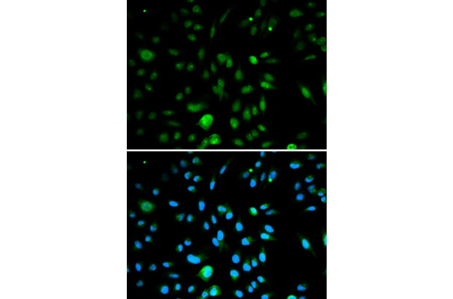 Anti-p16 INK4a Antibody from Bioworld Technology (BS6431) - Antibodies.com