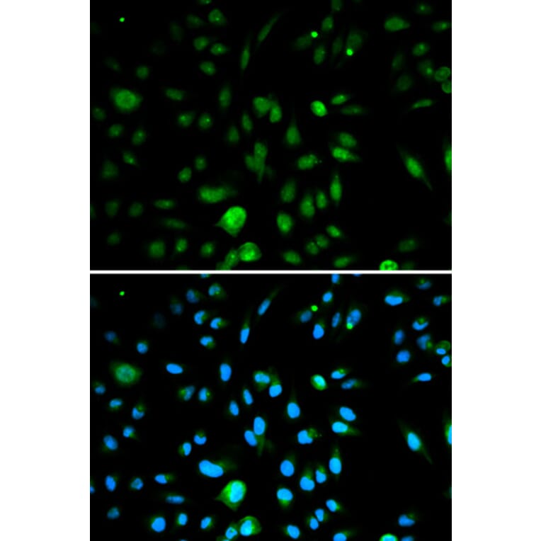 Anti-p16 INK4a Antibody from Bioworld Technology (BS6431) - Antibodies.com