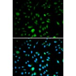 Anti-p16 INK4a Antibody from Bioworld Technology (BS6431) - Antibodies.com