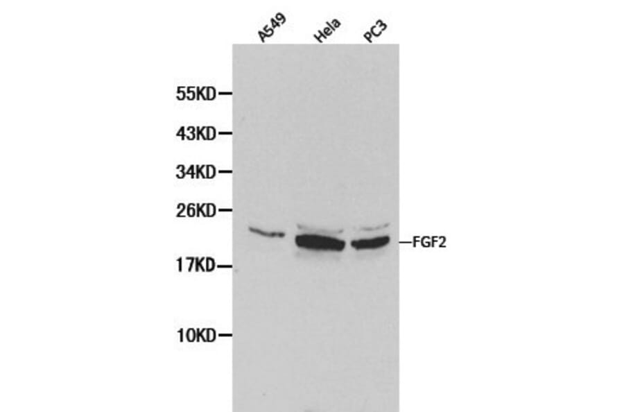 Anti-FGF Basic (FGF2) Antibody from Bioworld Technology (BS6432) - Antibodies.com