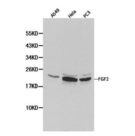 Anti-FGF Basic (FGF2) Antibody from Bioworld Technology (BS6432) - Antibodies.com